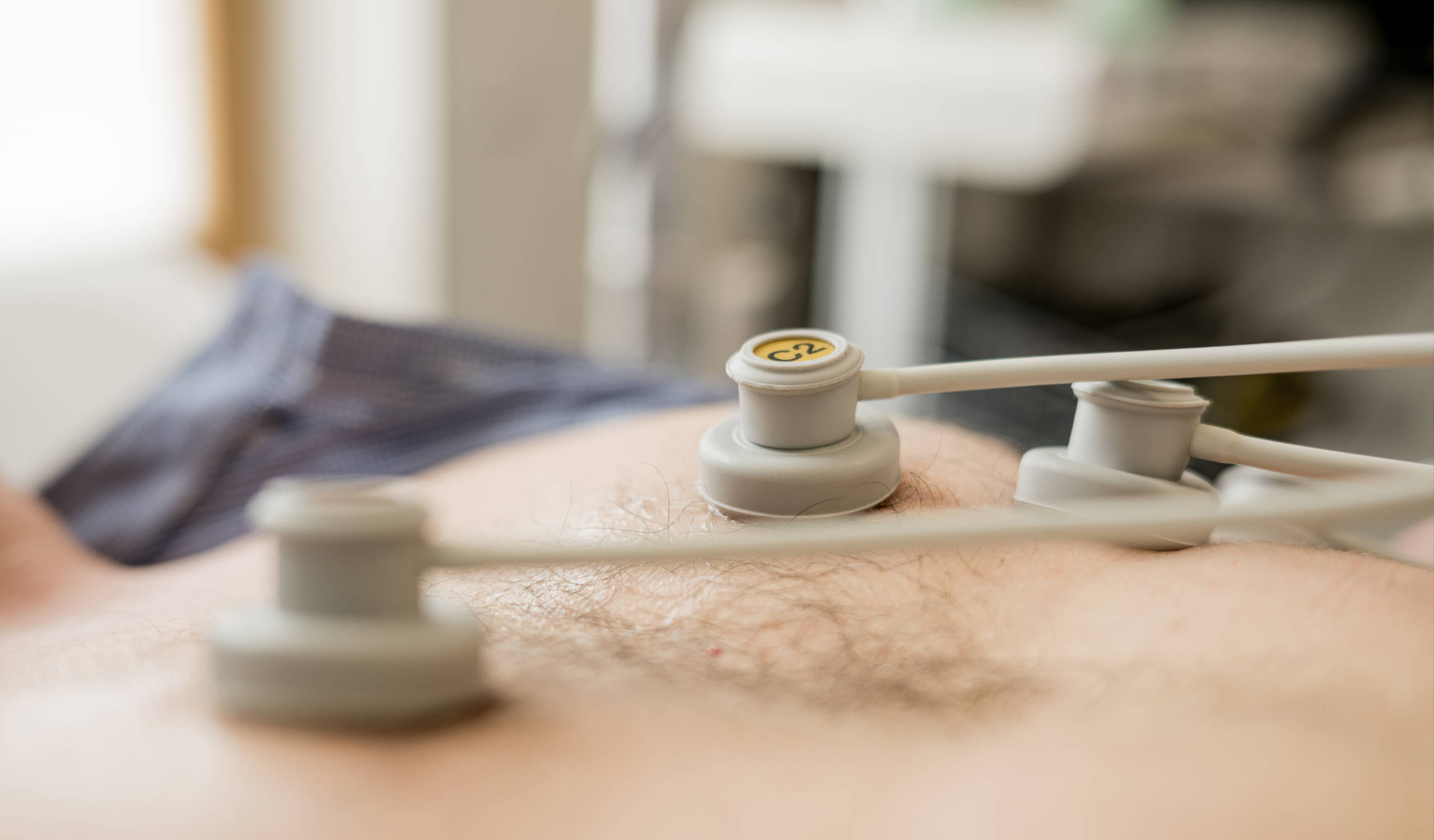 Elektrokardiogramm-Elektroden auf der Haut eines Patienten zur Herzüberwachung